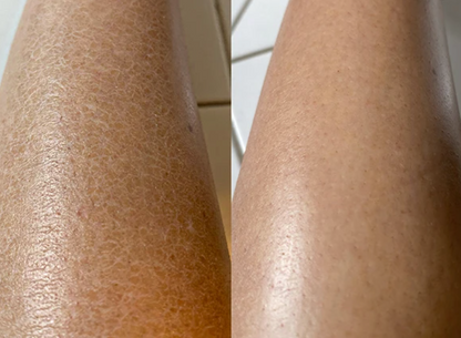 Dry Body Brush
